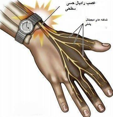 عصب رادیال دست