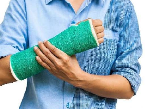 اولین اقدام بعد از شکستگی